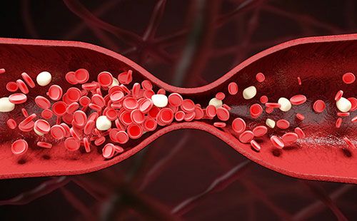 動(dòng)脈硬化檢測儀