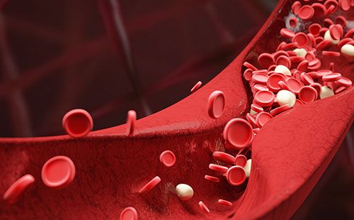 動脈硬化檢測儀