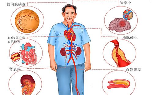動脈硬化檢測儀