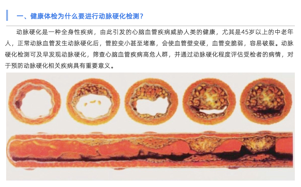 動(dòng)脈硬化檢測儀