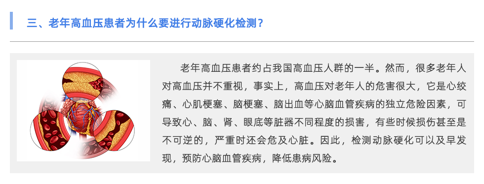 動脈硬化檢測儀