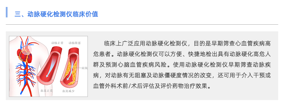 動脈硬化檢測儀