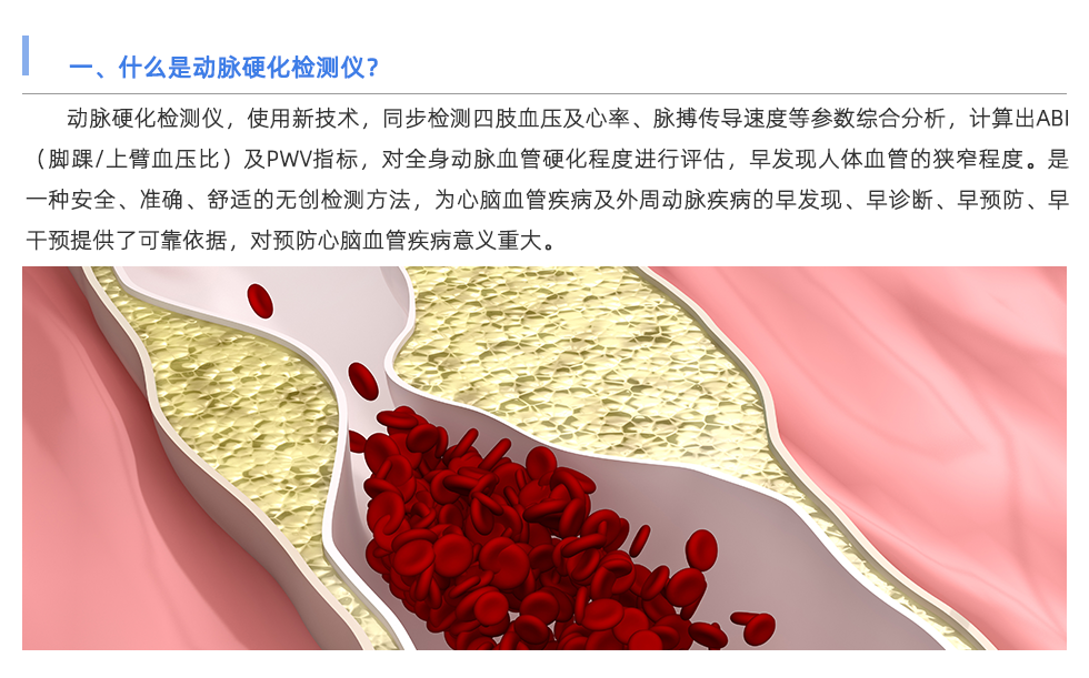 動脈硬化檢測儀