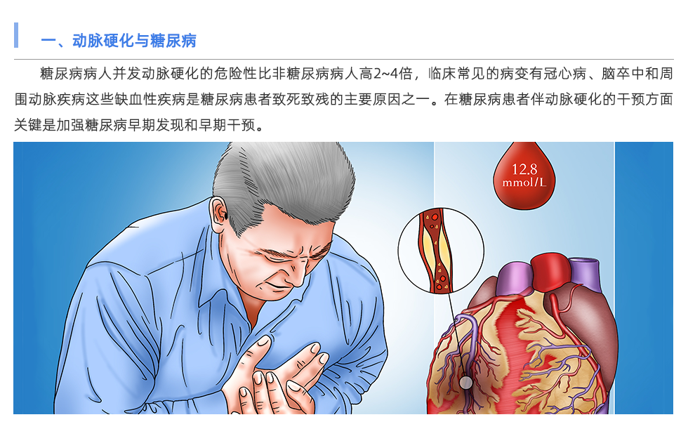 動(dòng)脈硬化檢測(cè)儀