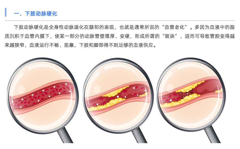 動脈硬化檢測儀