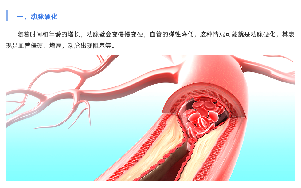 動(dòng)脈硬化檢測(cè)儀