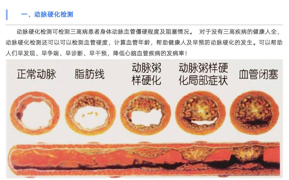 動(dòng)脈硬化檢測(cè)儀