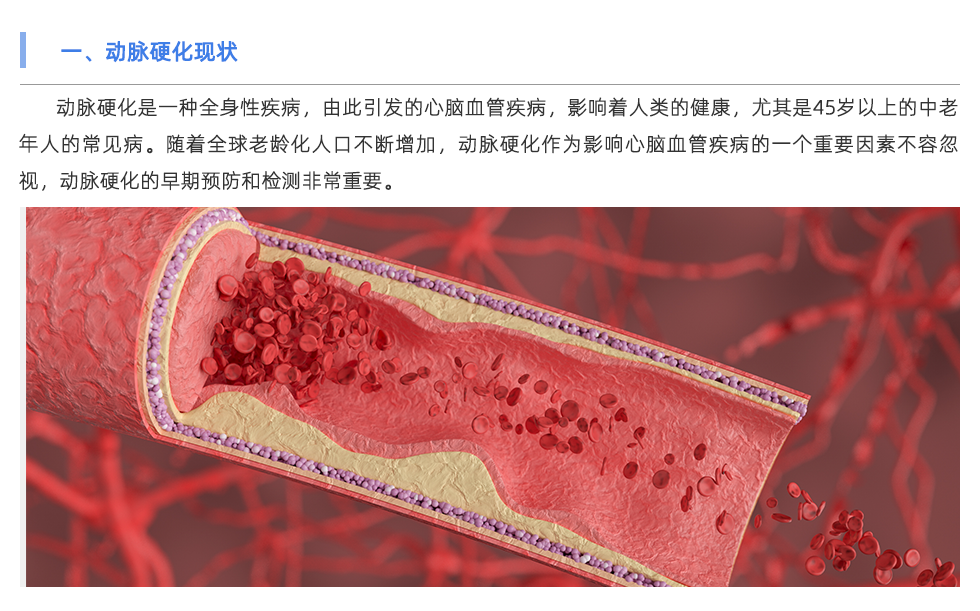脈搏波速測(cè)定儀