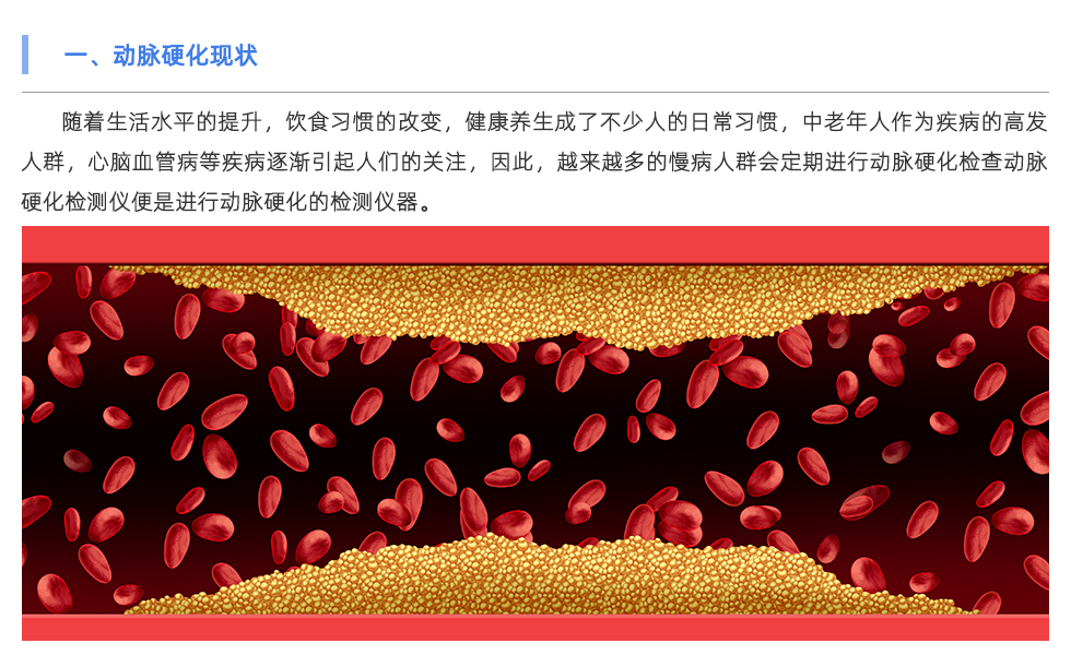 動(dòng)脈硬化檢測(cè)儀