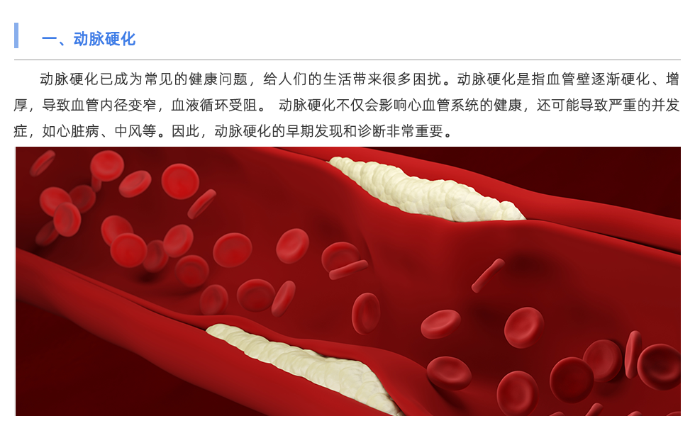 動脈硬化檢測儀