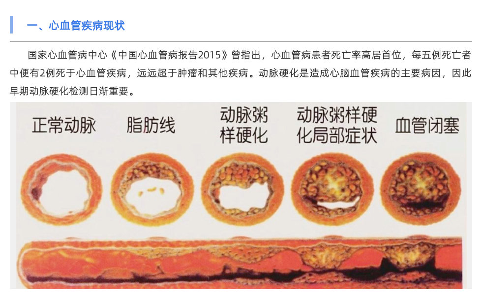 動(dòng)脈硬化檢測儀