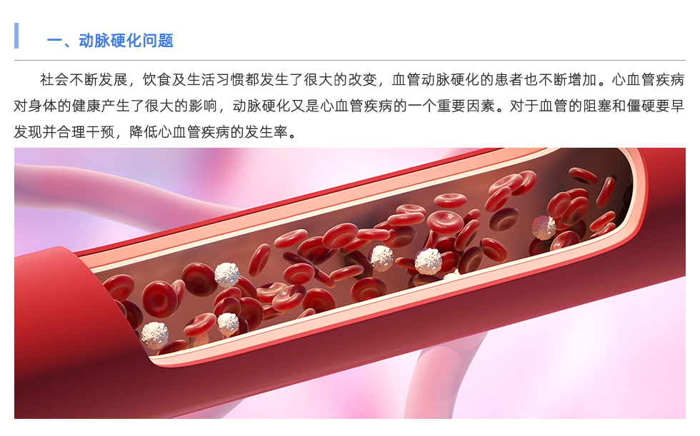 動脈硬化檢測儀