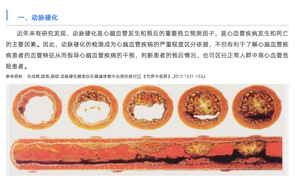 動脈硬化檢測儀