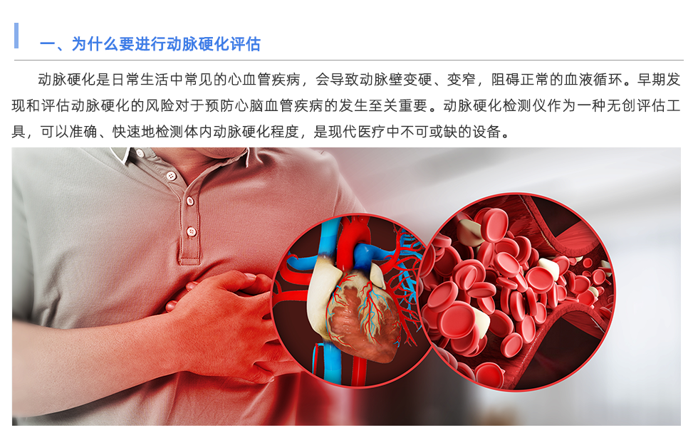 動脈硬化檢測儀