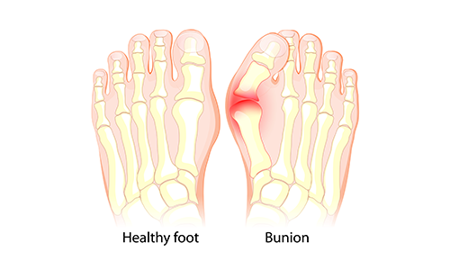 足底壓力測試儀
