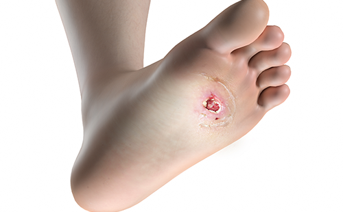 足底壓力測(cè)試儀