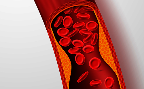 動(dòng)脈硬化檢測儀