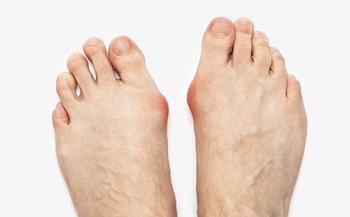 足底壓力檢測儀